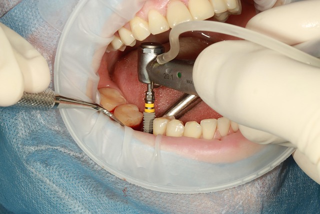Tratamentul holistic cu implant dentar